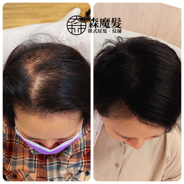 morehair_showcase_top-parting-47.jpg