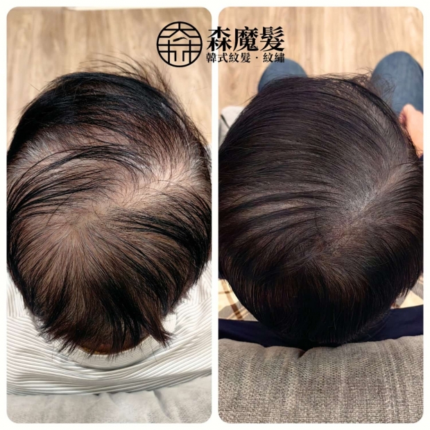 morehair_showcase_back-of-head-20.jpg