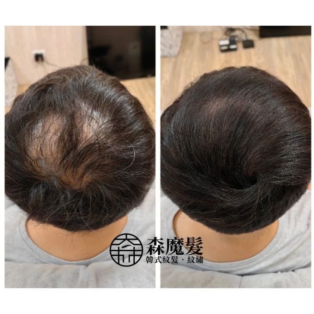 morehair_showcase_back-of-head-22.jpg
