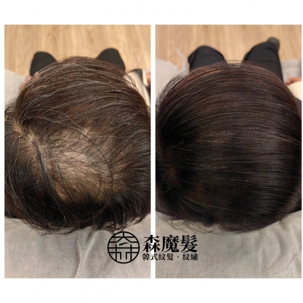 morehair_showcase_back-of-head-23.jpg