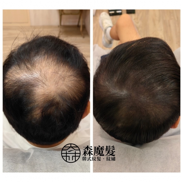 morehair_showcase_back-of-head-24.jpg