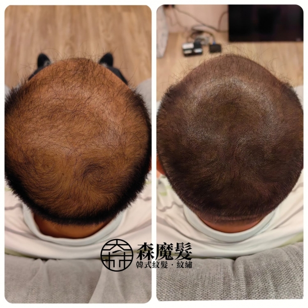 morehair_showcase_back-of-head-25.jpg