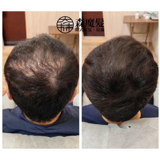 morehair_showcase_back-of-head-26.jpg