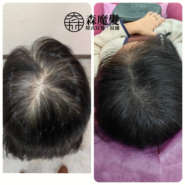 morehair_showcase_back-of-head-27.jpg