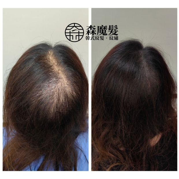 morehair_showcase_back-of-head-28.jpg