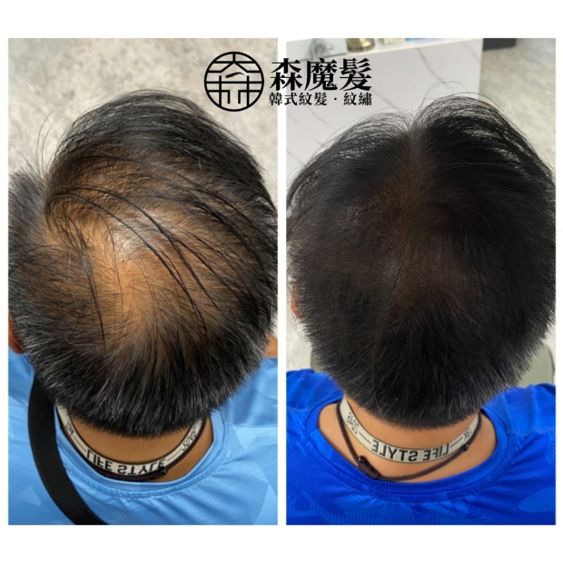 morehair_showcase_back-of-head-29.jpg
