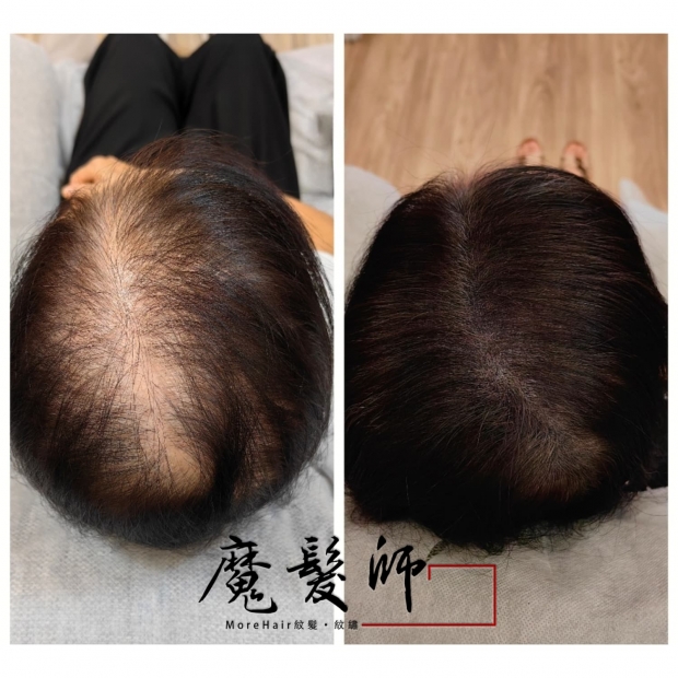 morehair_showcase_white-1.jpg