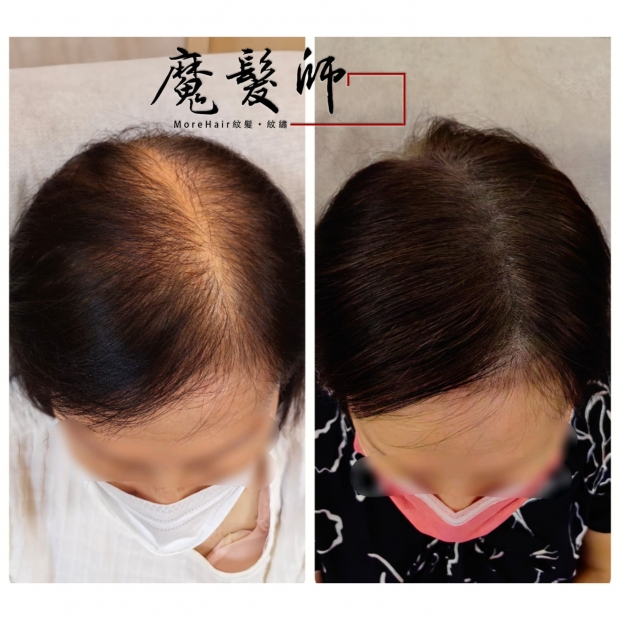 morehair_showcase_white-2.jpg