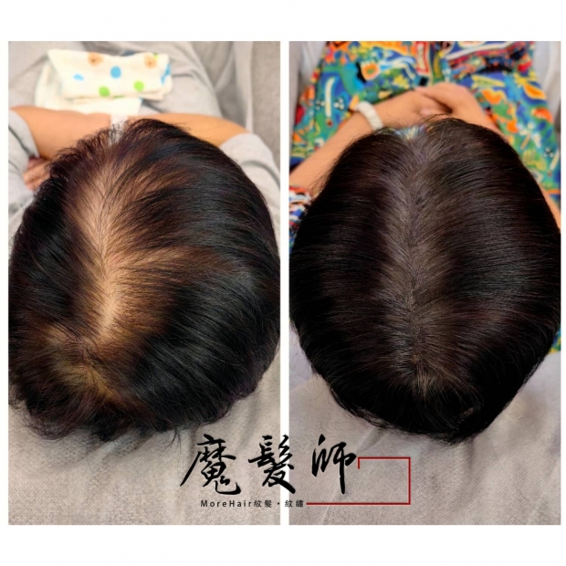 morehair_showcase_white-3.jpg