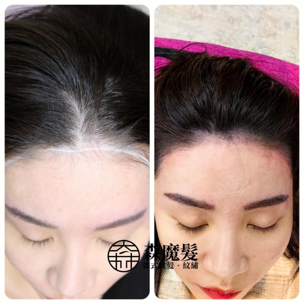 morehair_showcase_female-hairline-10.jpg