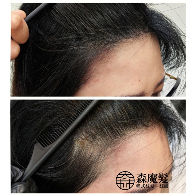 morehair_showcase_female-hairline-11.jpg