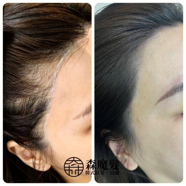 morehair_showcase_female-hairline-9.jpg