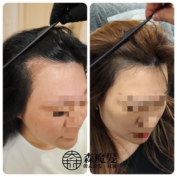 morehair_showcase_female-hairline-5.jpg