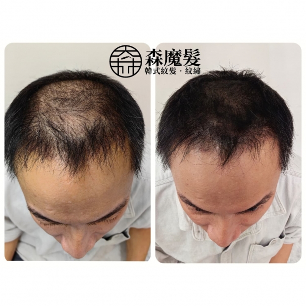 morehair_showcase_crown-area-17.jpg