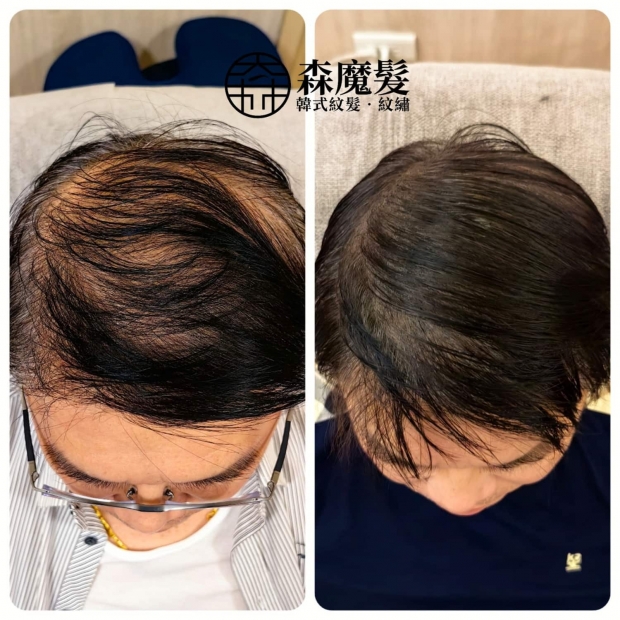 morehair_showcase_crown-area-12.jpg