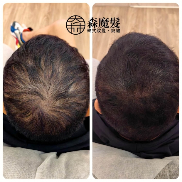 morehair_showcase_crown-area-13.jpg