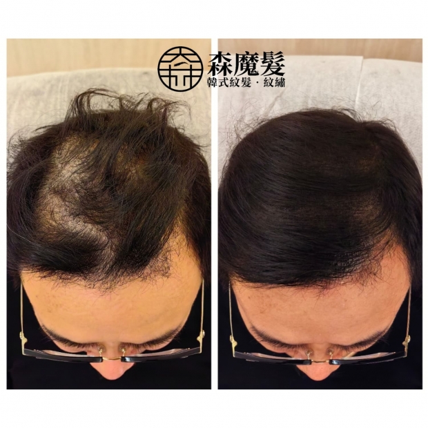 morehair_showcase_crown-area-14.jpg