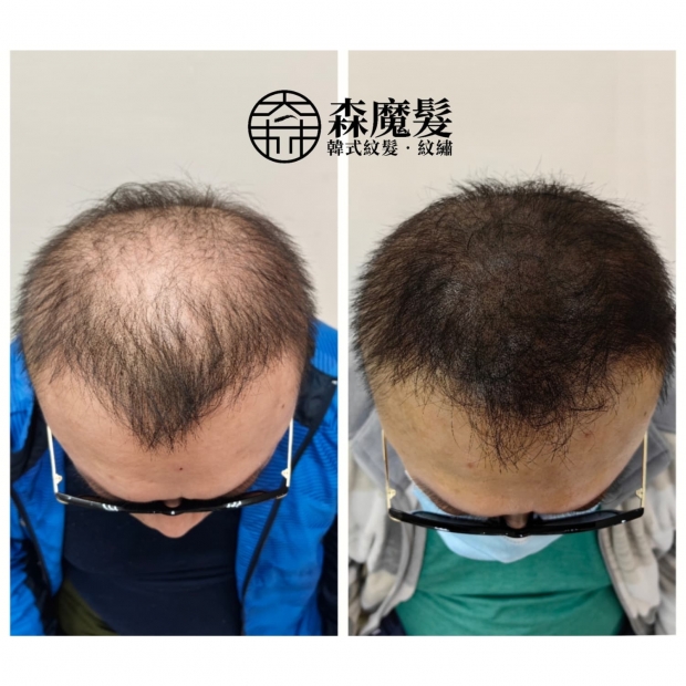 morehair_showcase_crown-area-16.jpg
